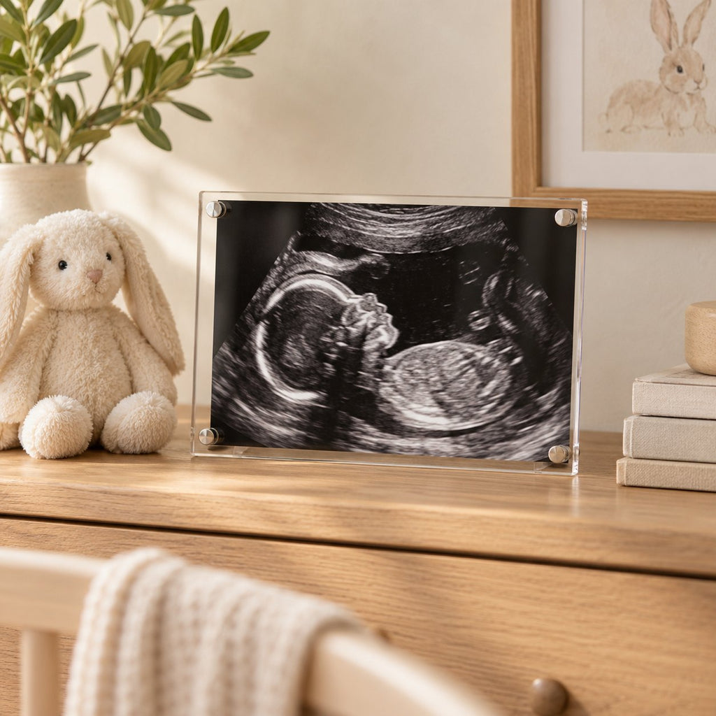 Ultrasound sonogram printed on clear acrylic with standoffs, displayed on a nursery dresser beside a plush bunny